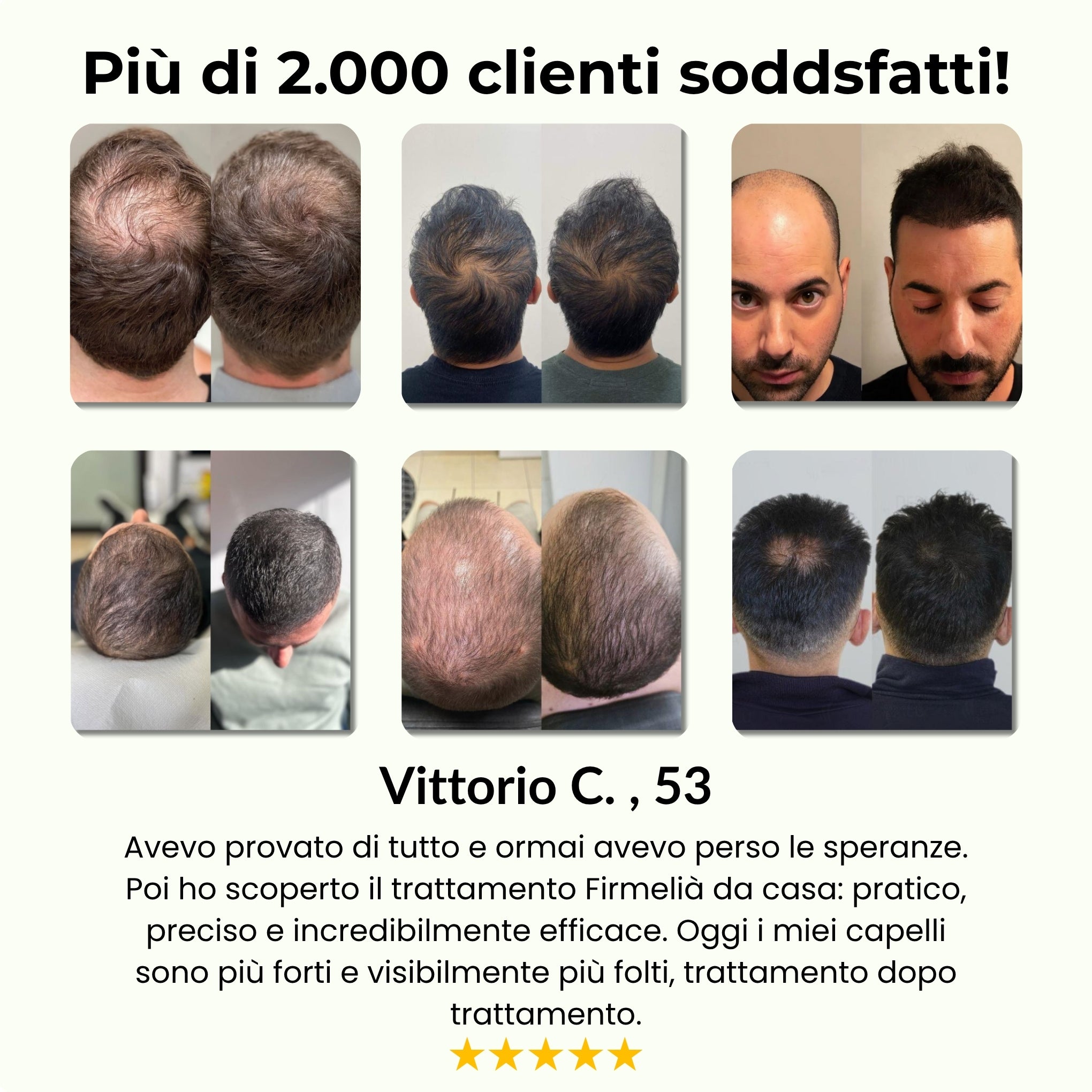 Firmelià® Sistema di Micro-Infusione per Ricrescita Capelli