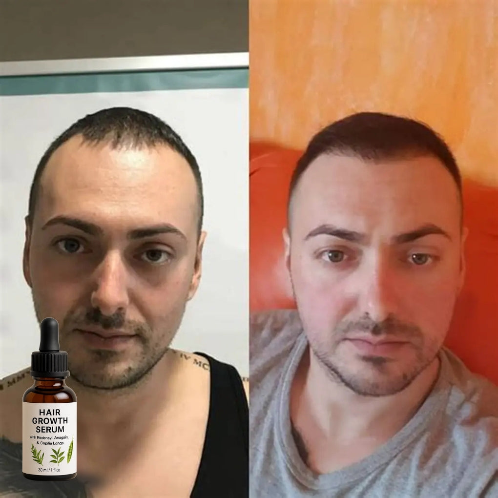 Firmelià Haargroeiserum na Behandeling