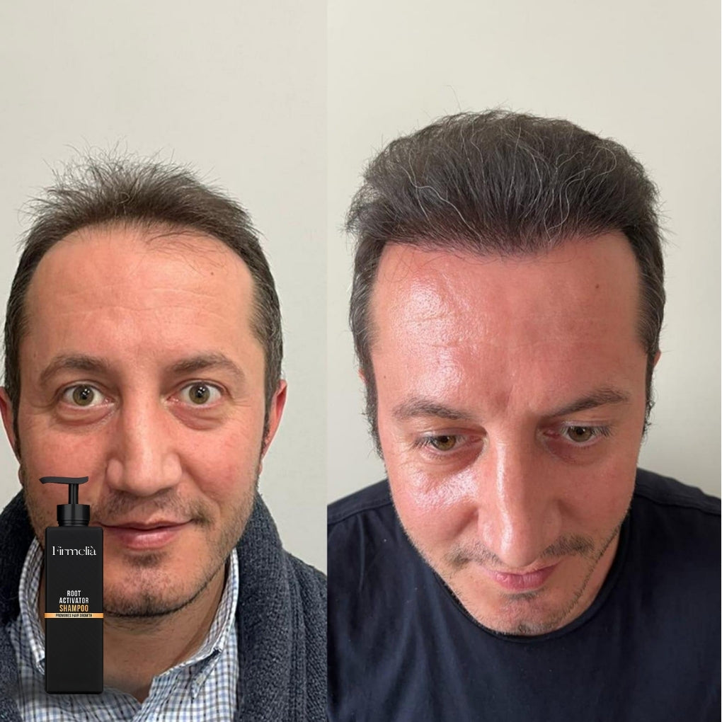 Firmelià Shampoo voor actieve follikelhergroei
