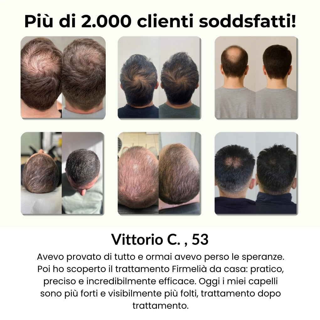 Firmelià® Sistema di Micro-Infusione per Ricrescita Capelli
