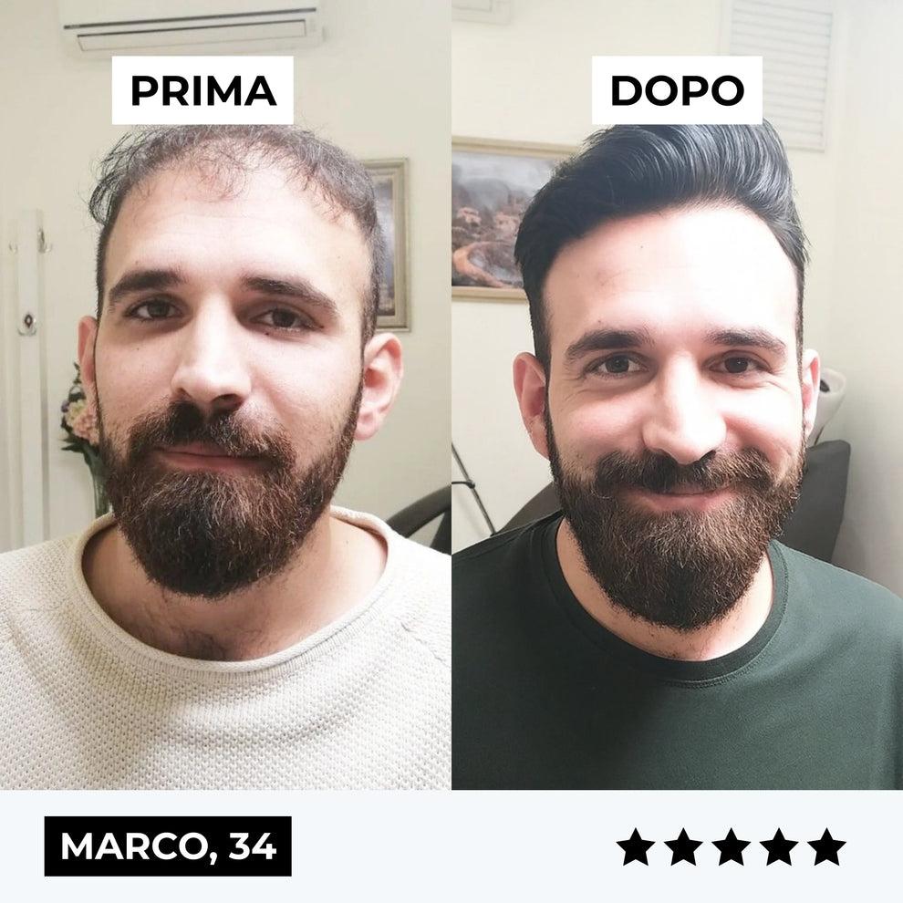 Firmelià™ Sistema ricrescita Capelli