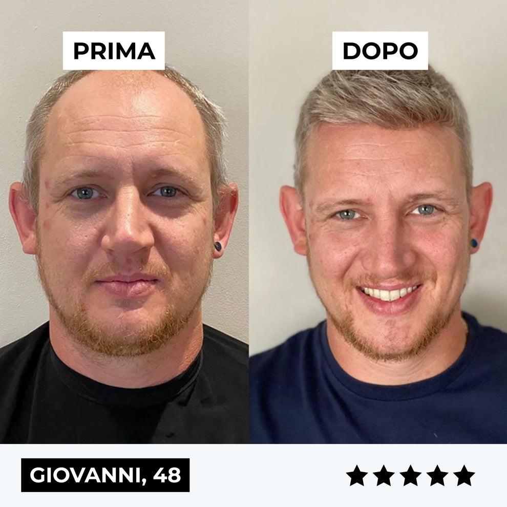 Firmelià™ Sistema ricrescita Capelli