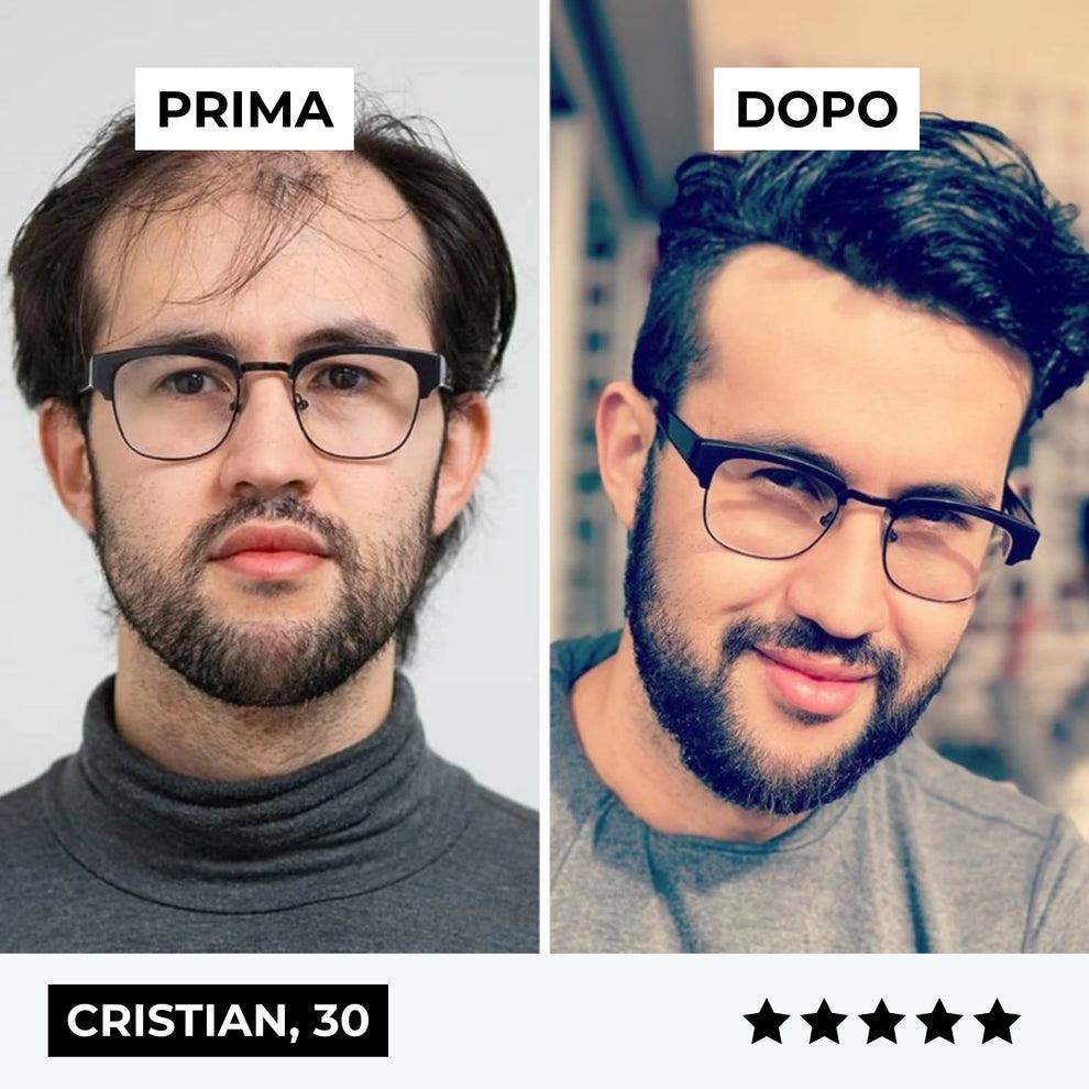 Firmelià™ Sistema ricrescita Capelli