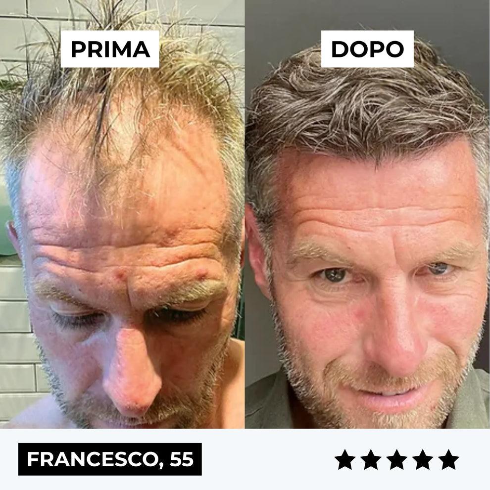 Firmelià™ Sistema ricrescita Capelli
